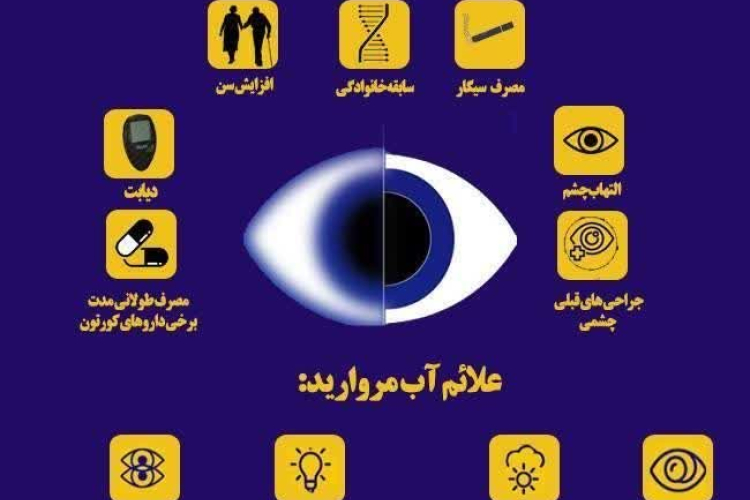 چه عواملی باعث آب مروارید چشم می‌شود؟